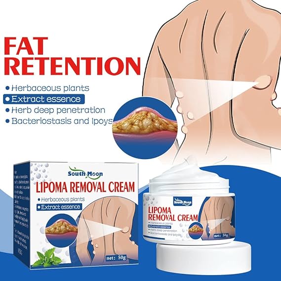South Moon Lipoma Removal Cream (Orignal)