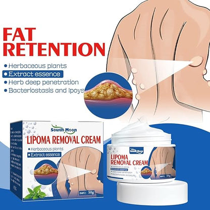 South Moon Lipoma Removal Cream (Orignal)