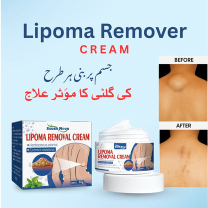 South Moon Lipoma Removal Cream (Orignal)