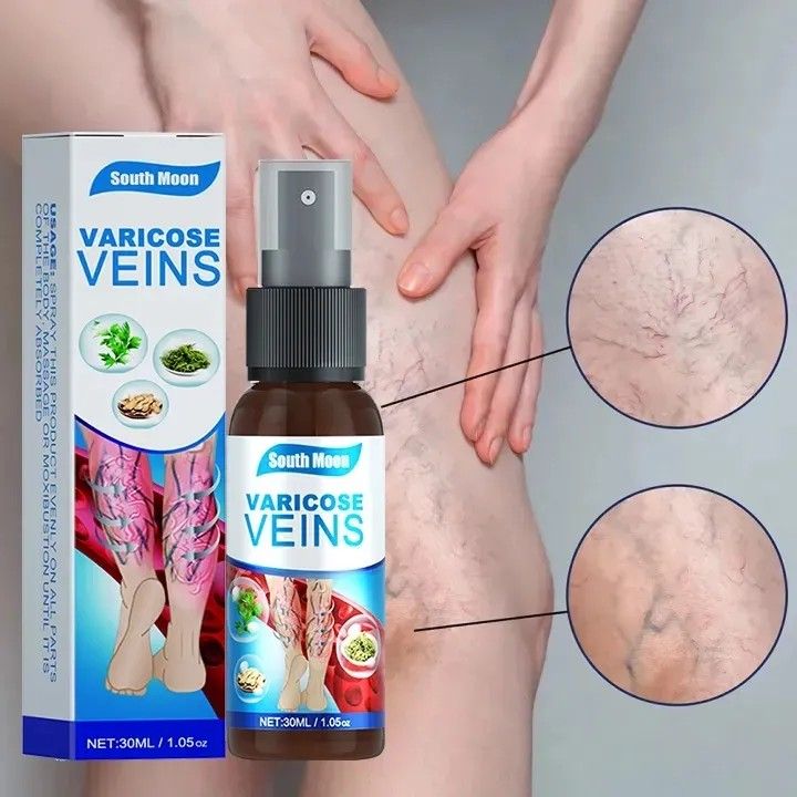 Varicose Veins Relief Spray (Orignal)